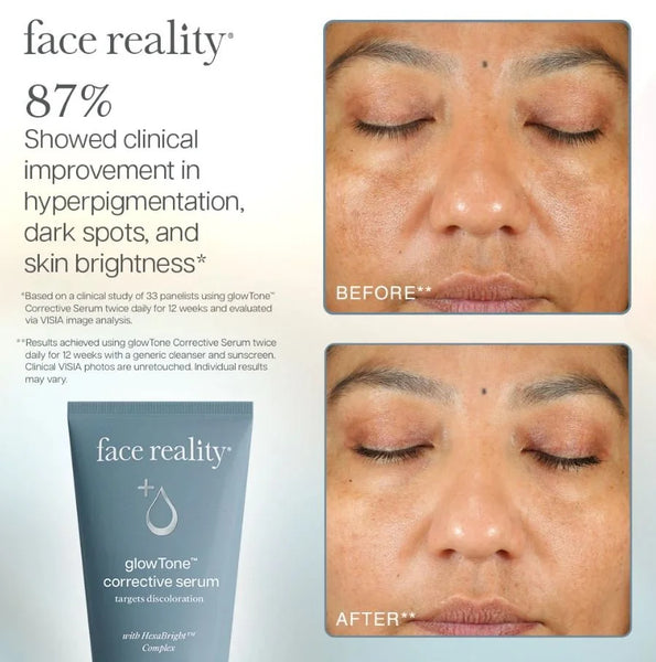 GlowTone™ Corrective Serum