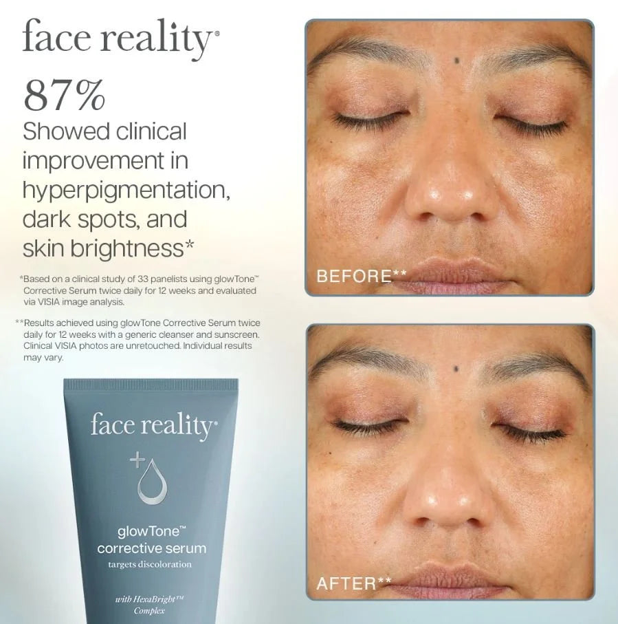 GlowTone™ Corrective Serum